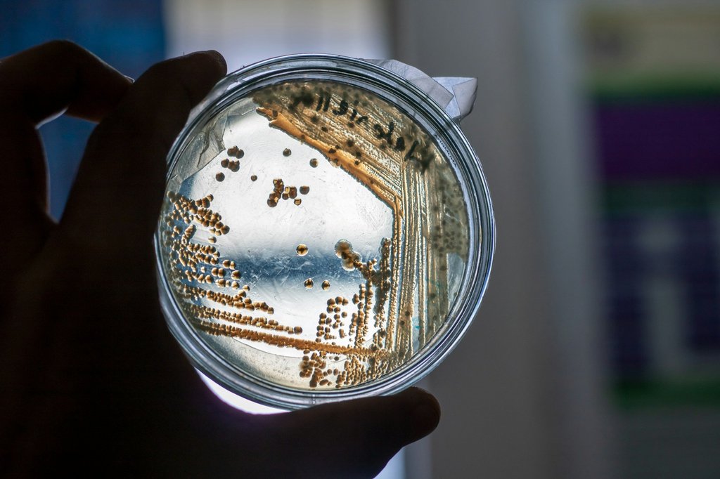 Petri dish with bacterial colonies